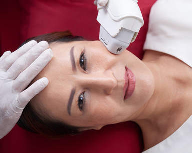 Female patient undergoing facial laser treatment